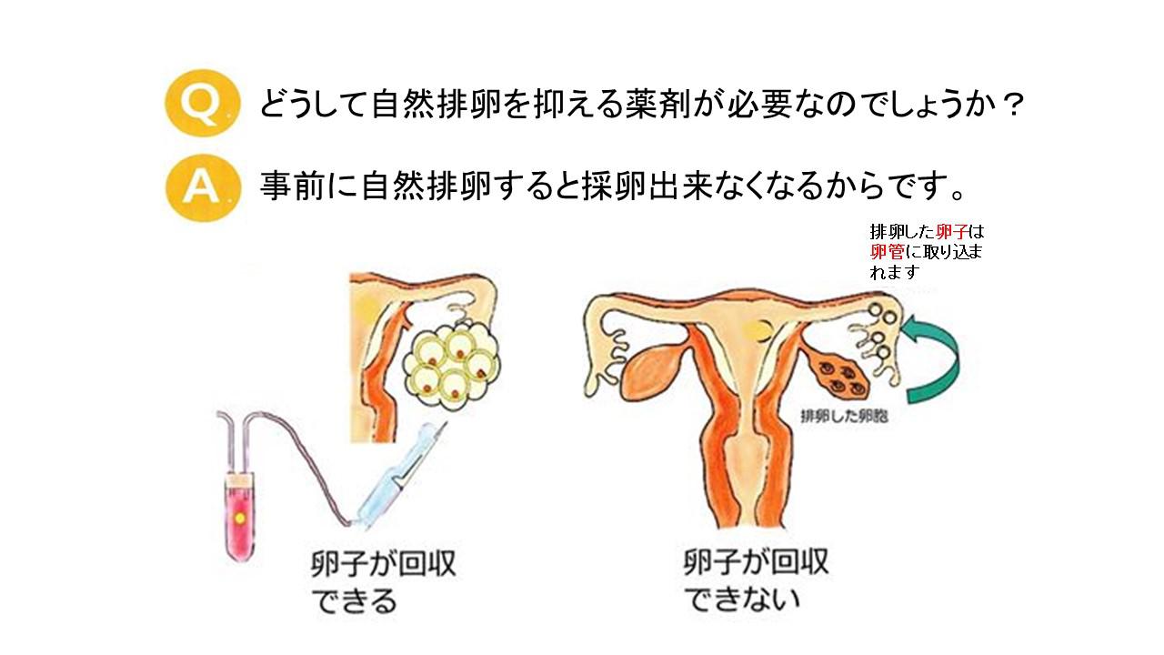 採卵 前 に 排卵