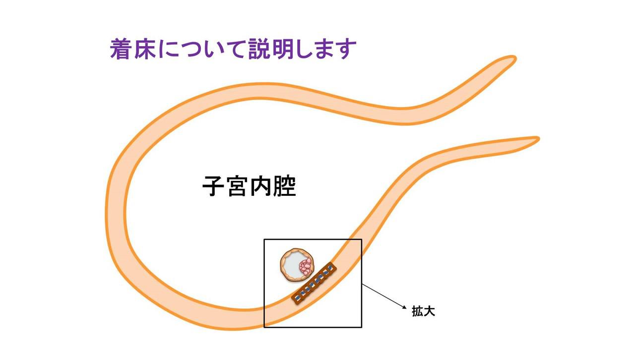 着 床 いつ