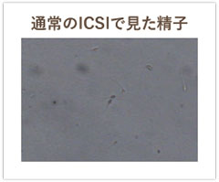 通常のICSIで見た精子