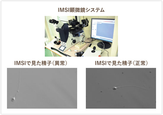 IMSI顕微鏡システムで見た精子