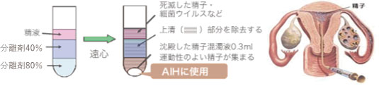 当院の人工授精の特徴